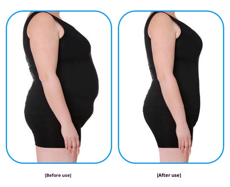 001 Fitness Massage Microcurrent Pulse Five-point Hip-lifting EMS Intelligent Abdominal Shaping Yoga Pants_voghion.com