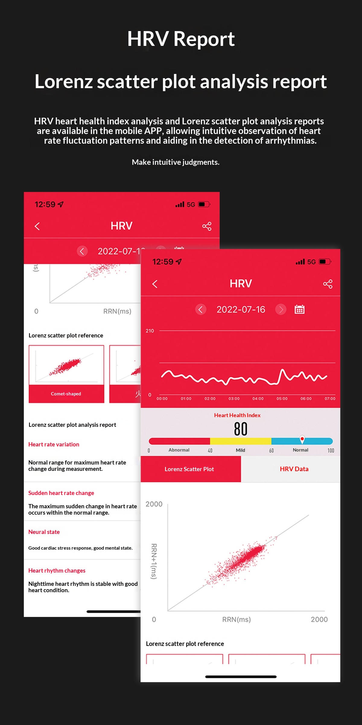 Smartwatch med ekg blodtryksmåler og pulsmåler_voghion.com