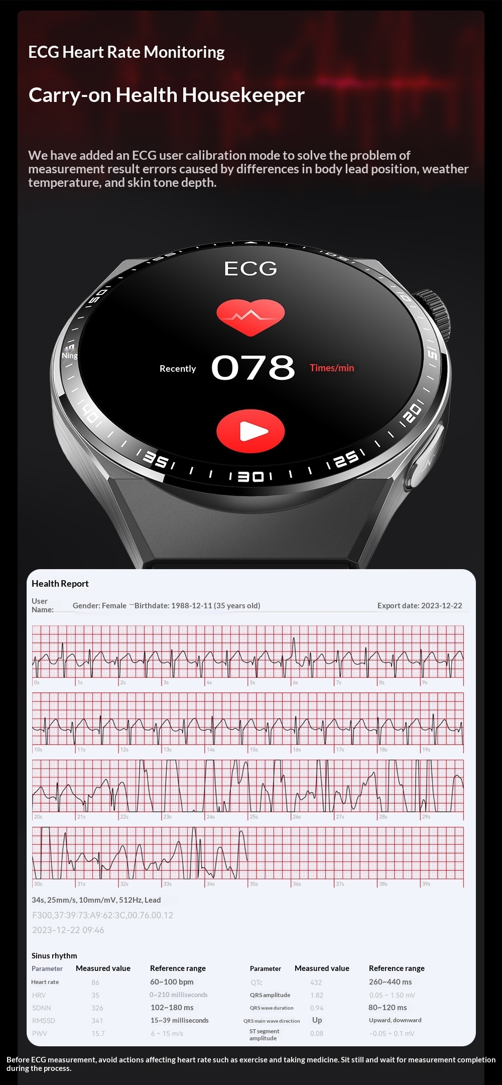 F800 Smartwatch Mit Bluetooth Telefonie Ekg Sos & Pulsmesser_voghion.com