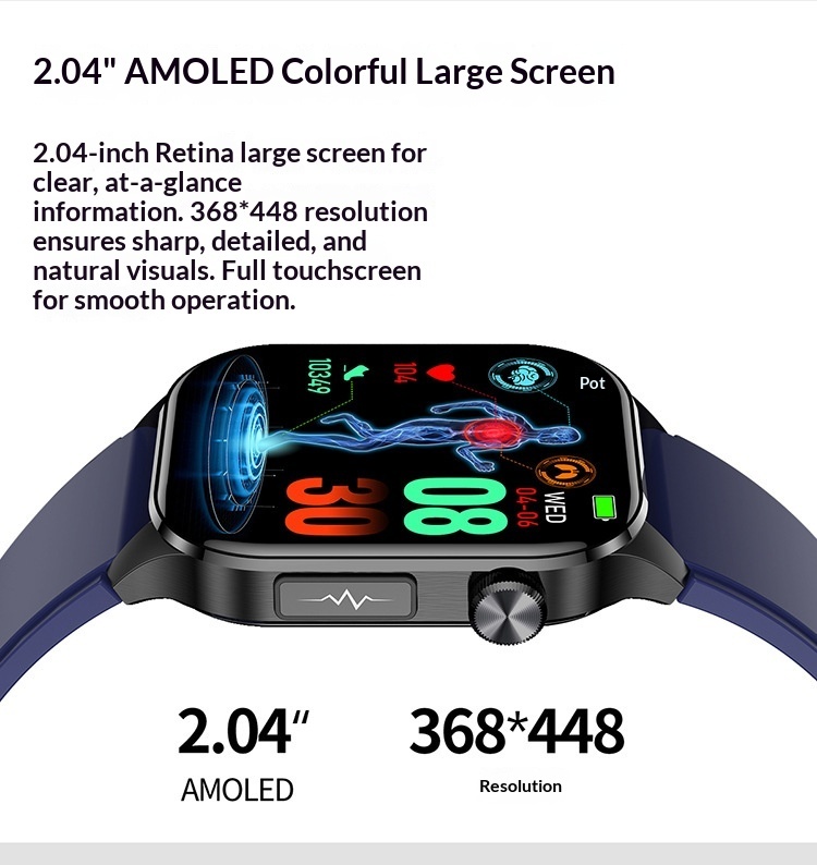 Smartwatch Et580 Mit Bluetooth-anruffunktion Und Gesundheitsmessung_voghion.com